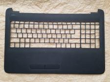 Верхня частина Hp&nbsp;15-AY078UR